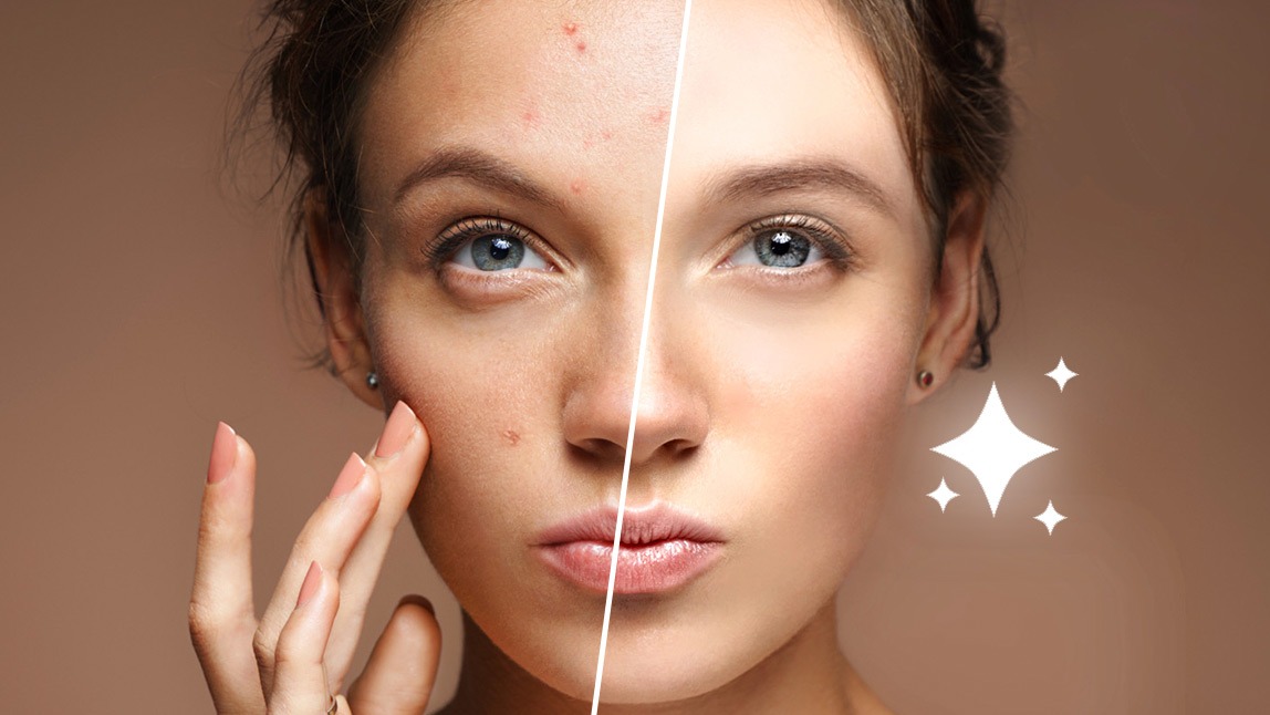 What is blemish photo remover